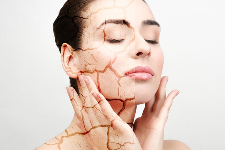 راه های محافظت از پوست در گرما